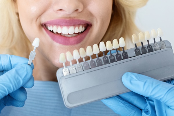 Everything You Need To Know About Dental Veneers